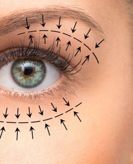 بلفاروپلاستی چیست و چگونه انجام میشود؟