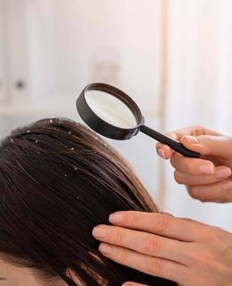 شوره سر؛ بررسی علائم و راهکارهای درمانی مؤثر