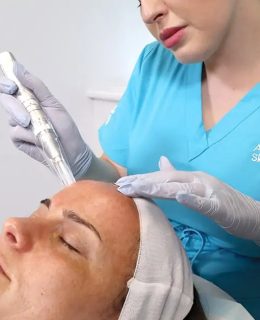 بررسی و آشنایی با روش‌های میکرونیدلینگ صورت و مزونیدلینگ