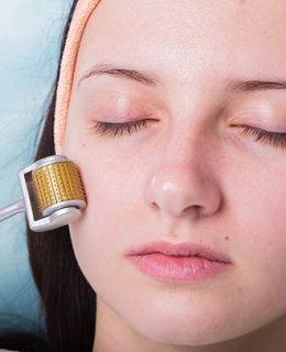 بررسی و آشنایی با روش‌های میکرونیدلینگ صورت و مزونیدلینگ