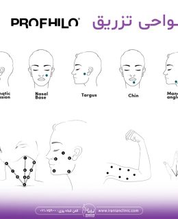 پروفایلو؛ معجزهای برای جوانسازی و احیای پوست