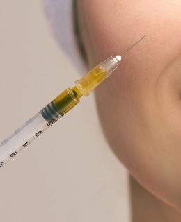 پی آر پی چیست و برای چه مواردی انجام میشود؟