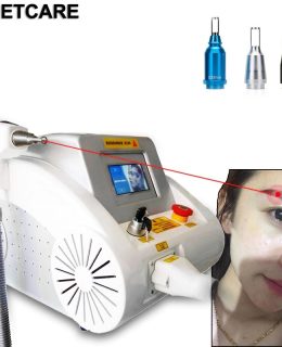 پاک کردن تتو؛ چگونه از طرحی که دیگر دوستش نداریم خلاص شویم؟